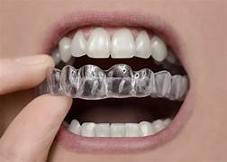 Types of retainers