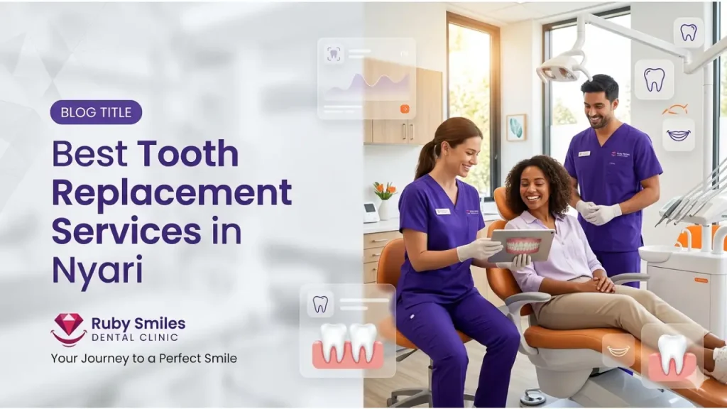 Best Tooth Replacement Services