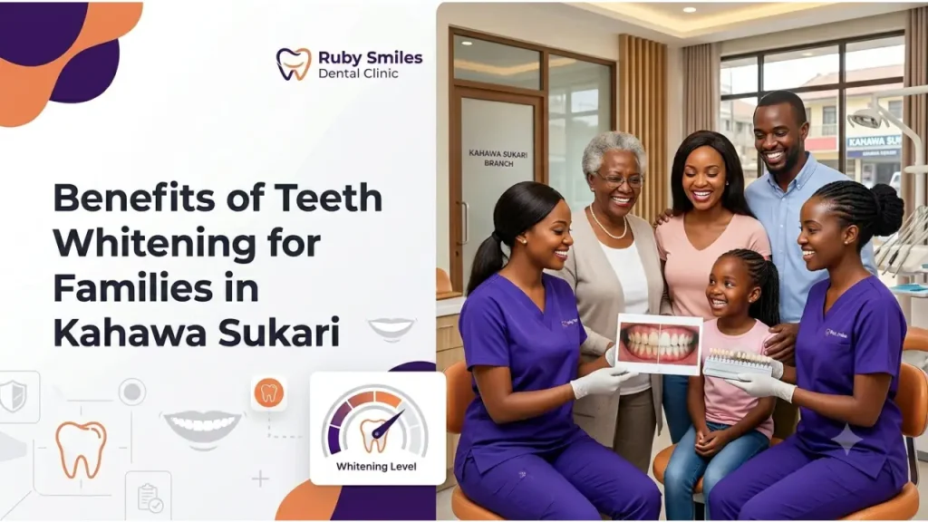 Benefits of Teeth Whitening