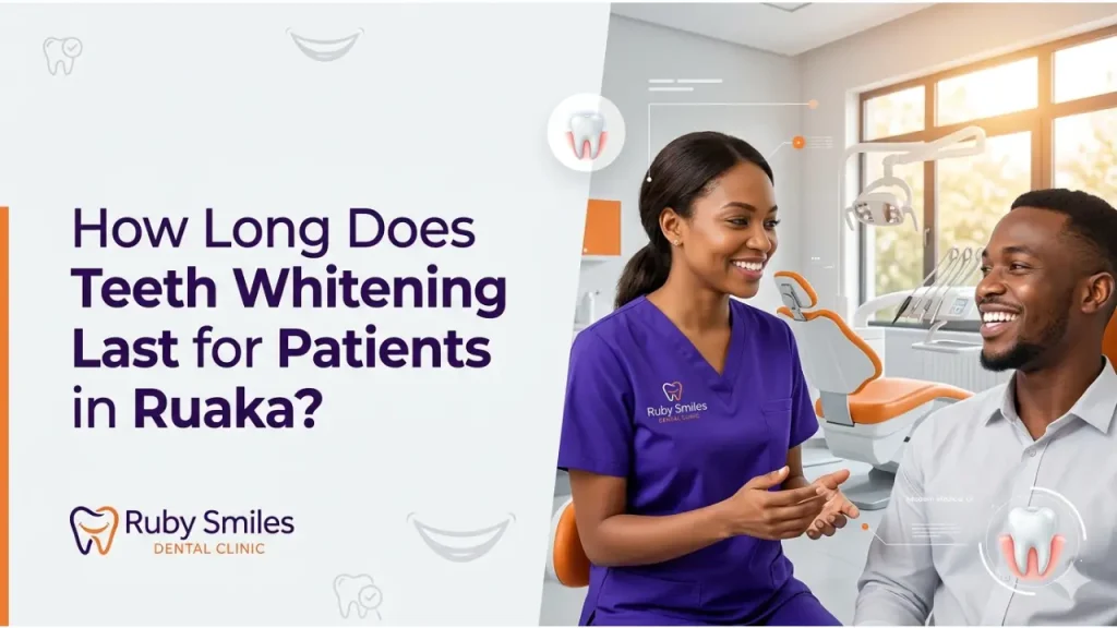 Teeth Whitening Lasting for Patients